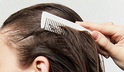 모든 두피에 적용 가능